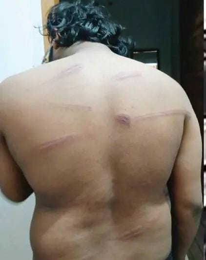 ഏറ്റുമാനൂരിലും പോലീസ് അതിക്രമം മുൻപോലീസുകാരന്റെ മകന് ക്രൂരമർദ്ദനം.